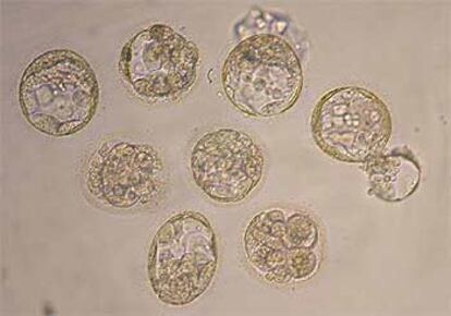 Ocho de los treinta embriones clonados, vistos por el  microscopio.