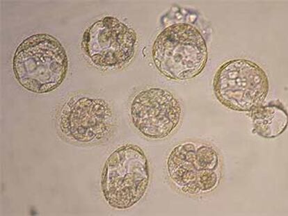 Ocho de los treinta embriones clonados, vistos por el  microscopio.