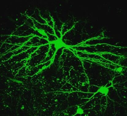 Imágen obtenida en vivo de las neuronas y las espinas dendríticas asociadas, en el cerebro de un joven pájaro que está aprendiendo a cantar.