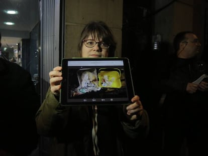 A resident shows a collection of needles.