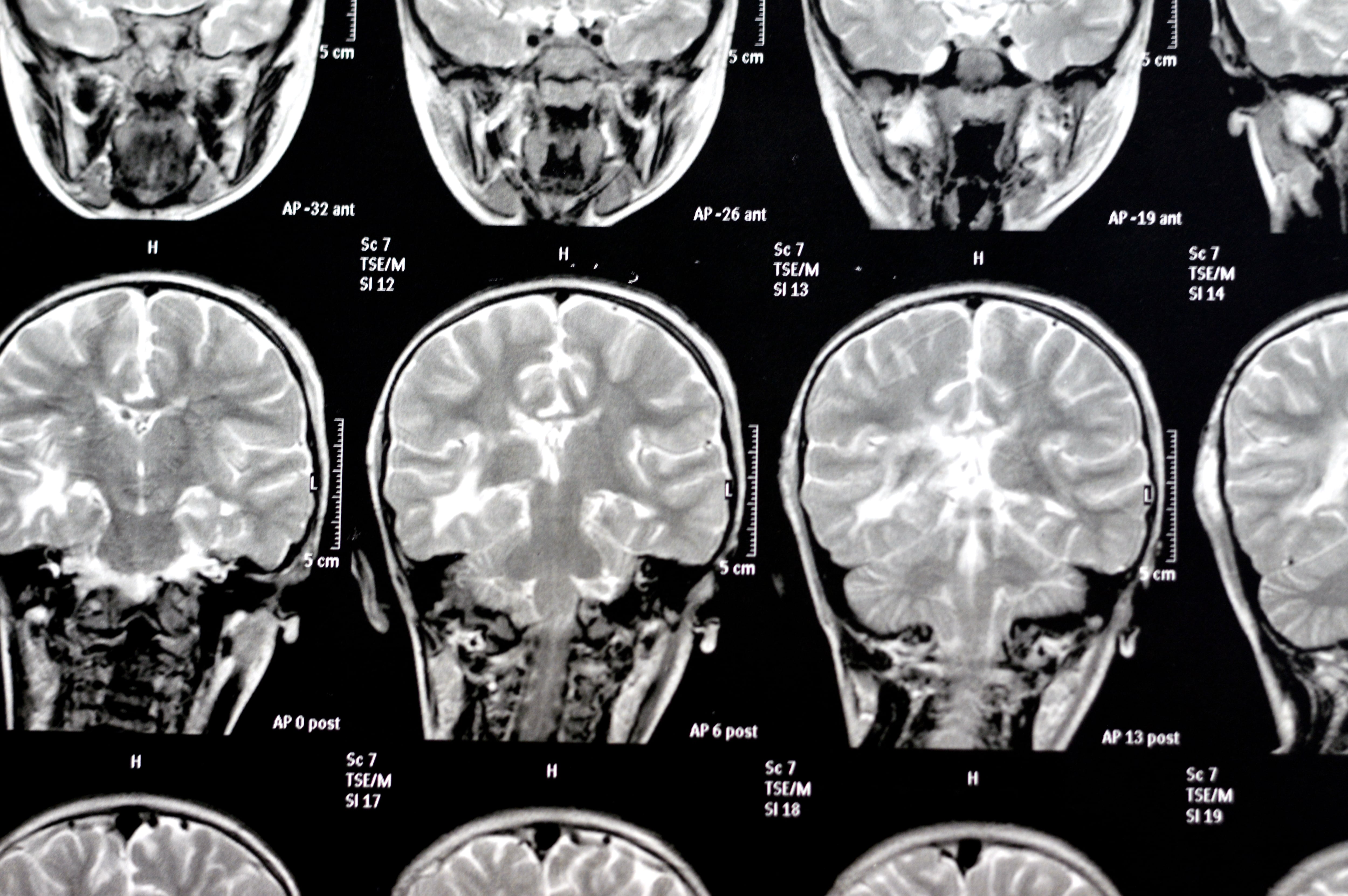 De Borges a Jennifer Aniston: la ciencia empieza a iluminar los misterios de la memoria