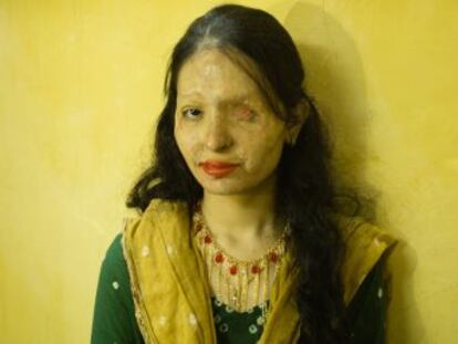 Reshma Qureshi sufrió una agresión que le destrozó la cara. Hoy es modelo y hace campaña para acabar con la venta de abrasivos