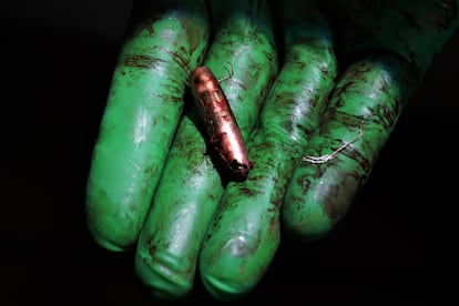 A medic shows a bullet removed from the arm of a wounded soldier.