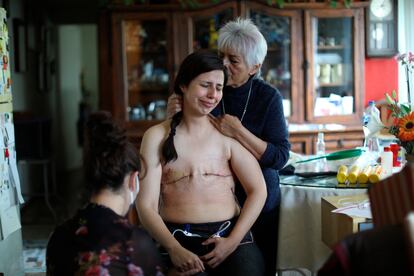 Sandra Monroy recibe ayuda de su madre, Teresa Mandrujano, y de su amiga Gina Ramírez, tres meses después de que se le practicara una mastectomía bilateral a causa del cáncer de mama que padecía, el 30 de septiembre de 2021. Monroy se enfrentó a la enfermedad y optó por no reconstruir sus senos e impulsar una red de acompañamiento para otras pacientes. 