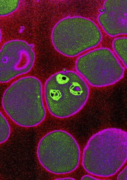 Imagen microscópica del Plasmodium Falciparum