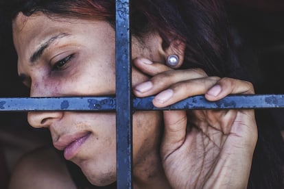 Una mujer transgénero muestra sus heridas en el centro de detención de Valencia, Carabobo (Venezuela), en 2017.