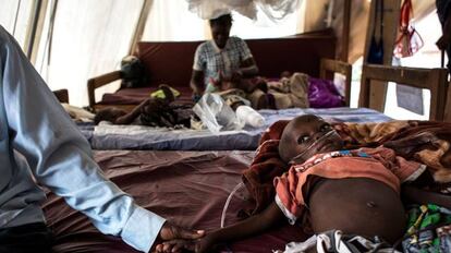 Un padre agarra la mano de su hijo desnutrido mientras este se recupera en un centro de rehabilitación de Tshikapa (República Democrática del Congo).