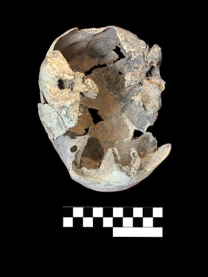 Cráneo con perforaciones de una anciana hallado en el dolmen de El Pendón.