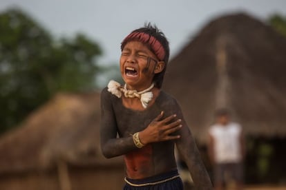 O braço é a parte do corpo mais atingida. Segundo explicou o irmão do cacique da aldeia, Elias Tsirobo, depois da "luta de raízes", os garotos passam alguns dias sem conseguir vestir camiseta, com os braços inchados.