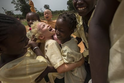 Aisha juega con sus compañeros a la salida de la escuela en el barrio de Missira, en la ciudad de Bissau. Aisha es albina y tiene una discapacidad visual muy característica de las personas con albinismo, aunque esto no le impide jugar y divertirse como el resto de niños de la escuela. Está muy integrada en el entorno escolar, tiene montones de amigos y es una niña muy extrovertida y participativa. 