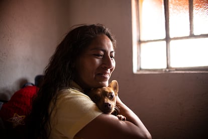 Josefina, en Oaxaca de Juárez, espera su próxima operación de labio, que le borrará una cicatriz de la cara, resultado de una mala cirugía.  