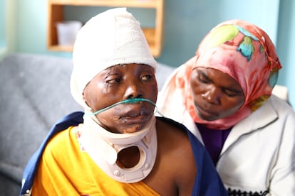 Lukia Akimu, una superviviente de las inundaciones en Malaui, está internada en el hospital Queen Elizabeth Central en Blantyre, al sur del país. El presidente, Lazarus Chakwera, dijo este miércoles, durante su visita a las zonas más afectadas, que más de 80.000 personas han sido desplazadas. 
