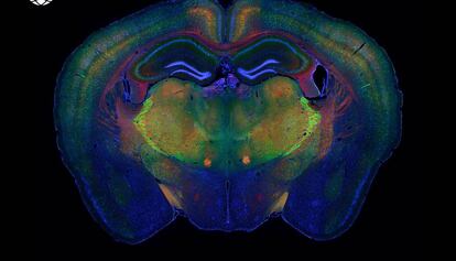 El cerebro de un ratón con los diferentes tipos celulares destacados.