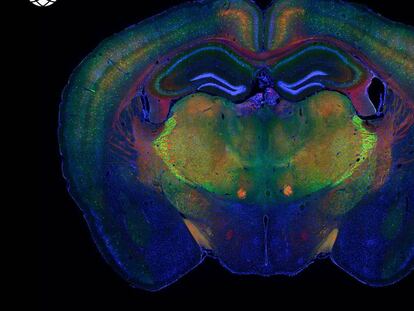 El cerebro de un ratón con los diferentes tipos celulares destacados.
