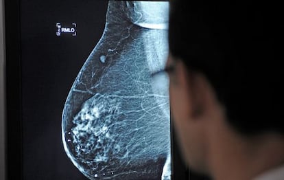 Una mamograf&iacute;a en el hospital Virgen del Rocio de Sevilla 