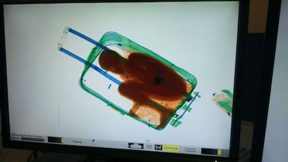 An X-ray image of Adau in the suitcase at the El Tarajal (Ceuta) border post in 2015.