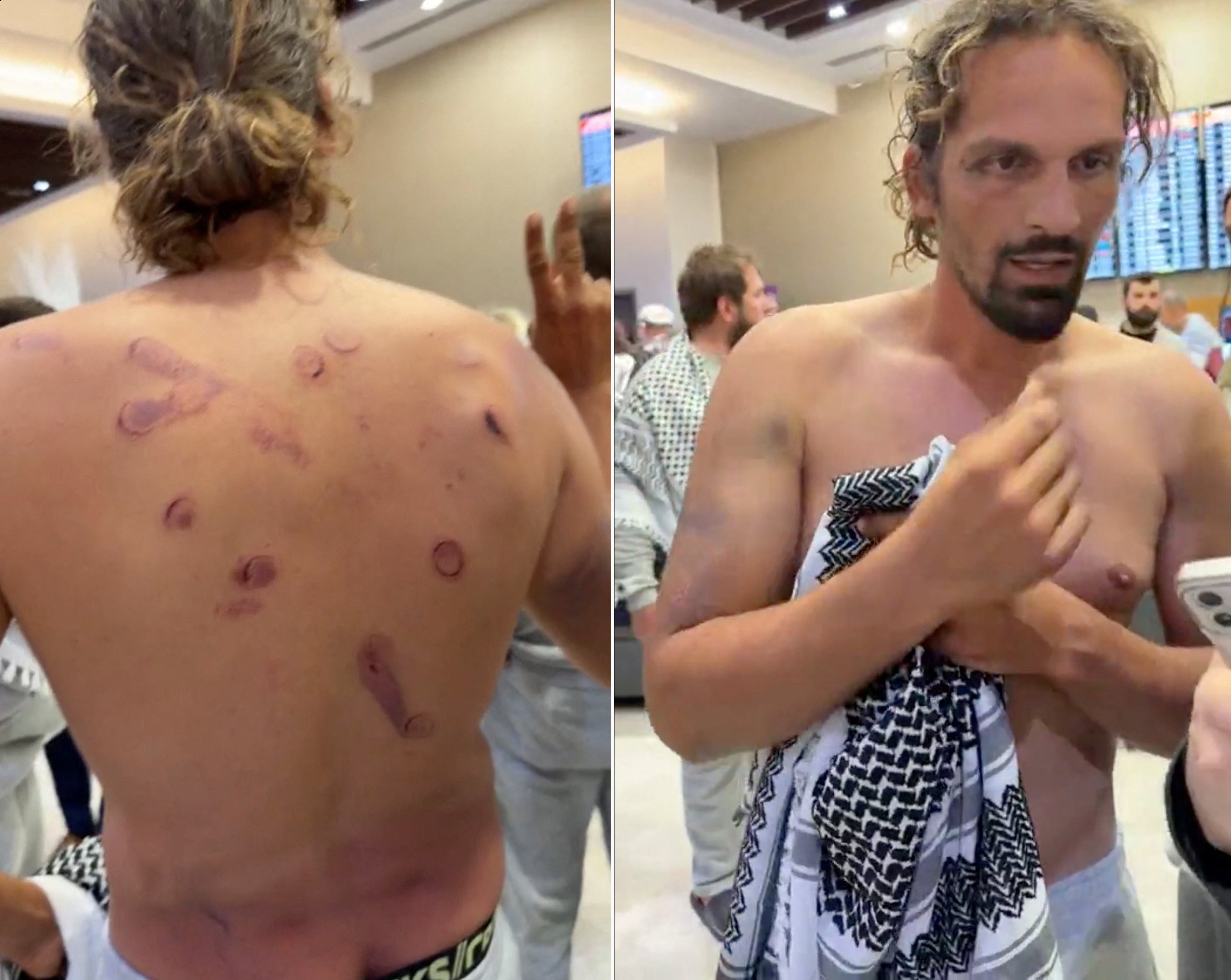 Parte médico de la flotilla: huesos fracturados, heridas de balines y agresiones sexuales