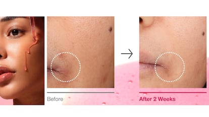 Este sérum de Anua destaca por su fórmula con niacinamida.