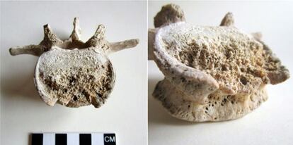 Una de las vértebras del hombre pompeyano analizadas para el estudio.