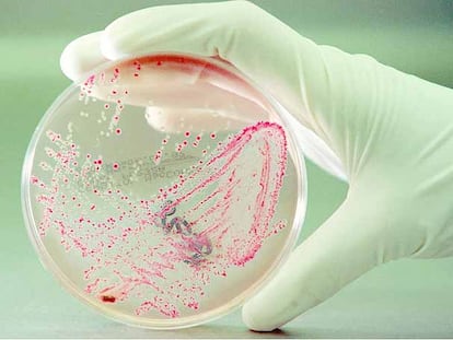 Un cultivo de la bacteria E. coli en un laboratorio.