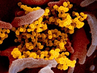 Una imagen al microscopio del virus
