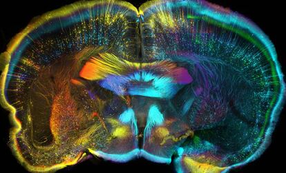 Vista coronal del cerebro de un ratón. Las 20 fotografías seleccionadas en esta edición de los premios Wellcome Images se expondrán en 11 instituciones científicas, museos y galerías en Reino Unido y Estados Unidos, incluyendo el prestigioso Instituto Tecnológico de Massachusetts (MIT).