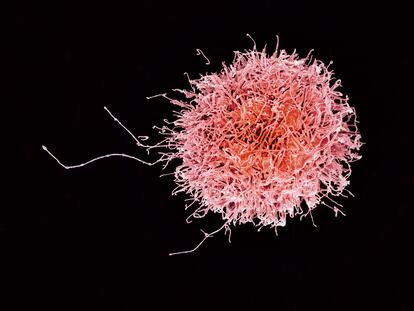 A cancer cell as seen through a microscope.