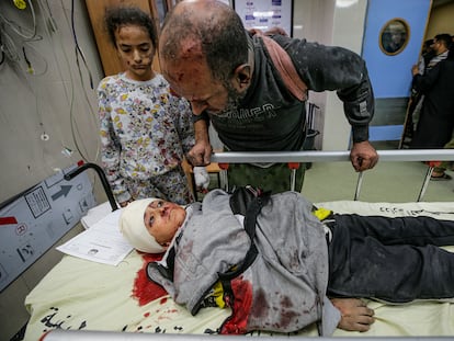 Una familia palestina herida por los ataques aéreos israelíes en la ciudad de Jan Yunis, este miércoles en el hospital de Nasser, en Gaza.