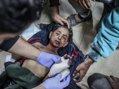 Un niño herido a causa de un ataque al campo de refugiados de Al Maghazi  recibe atención médica en el hospital Aksa, en Deir al Balah, este lunes.