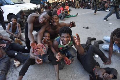 Migrants show their injuries after making it over the border fence in Ceuta on July 26.