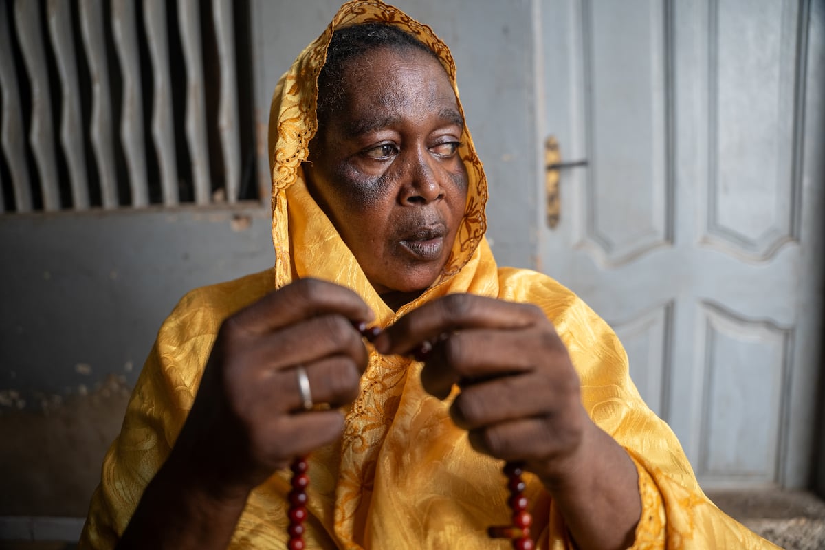Skin bleaching at the expense of health in Senegal: ‘It’s like a drug. They can’t break the habit, even while knowing the risks’