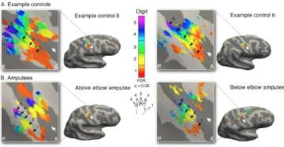 Imágenes del cerebro utilizadas en el estudio que han aportado los autores.