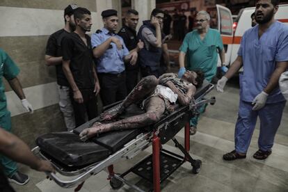 Varios sanitarios trasladan a un herido por un bombardeo israelí este martes al Hospital Nasser, en Jan Yunis, en el sur de Gaza.