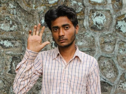 Hasiruddin Ansari, enfermo de lepra, vive en Bombay.