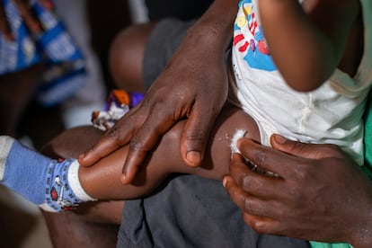 Un bebé que acaba de recibir la primera vacuna contra la malaria en Douala (Camerún), este pasado lunes.  