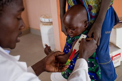 Hoy Bakary se ve muy recuperado. La cinta que mide el perímetro de su brazo señala que ha salido de la zona de peligro: si midiera menos de 11 centímetros significaría que padece malnutrición severa aguda, pero da 14. Se ha recuperado gracias al Plumpy Nut, el complemento terapéutico que salva millones de vidas en los países más pobres: 500 kilocalorías a base de cacahuetes, vitaminas y minerales.