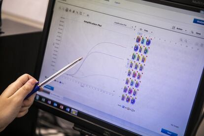 <p>La PCR, la prueba para diagnosticar el coronavirus, es una de las técnicas más complejas. Lo explica Patricia Muñoz, jefa de servicio de Microbiología del Marañón: "Ahora está más automatizado e incluso algunos hospitales tienen 'robots' para analizar la prueba. Aquí nos manejamos de forma manual". Cuando Muñoz habla, tiene al lado a Pilar Catalán y Roberto Alonso, dos microbiólogos. "Ellos, que ya eran expertos, son los responsables de haber enseñado en tiempo récord a manejarse con las PCR al resto del equipo", sonríe la jefa de la unidad. "Esperemos que esto sirva para reforzar el equipo, no solo frente a una pandemia, sino a largo plazo, a futuro".</p><p>En la imagen, una PCR positiva que visibilizan las dos líneas superiores.</p>