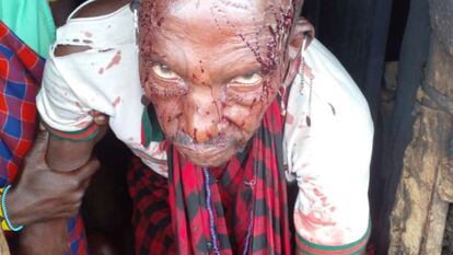 En la imagen, un hombre de la comunidad masái de Loliondo herido tras el estallido de violencia con la policía el viernes 10 de junio de 2022. El vídeo, sonidos de disparos a la comunidad masái del norte de Tanzania.