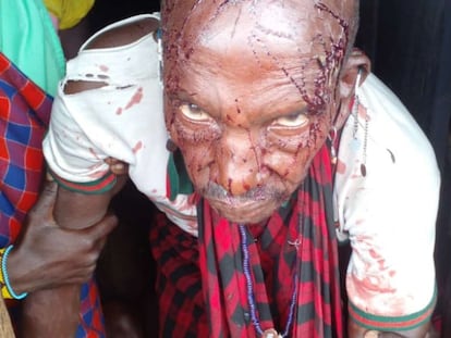 En la imagen, un hombre de la comunidad masái de Loliondo herido tras el estallido de violencia con la policía el viernes 10 de junio de 2022. El vídeo, sonidos de disparos a la comunidad masái del norte de Tanzania.