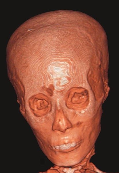 El rostro de la momia de Tutankamón.