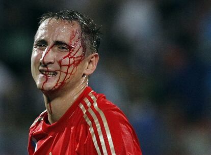 Vladimir Bystrov, sangrando durante el partido ante Israel.
