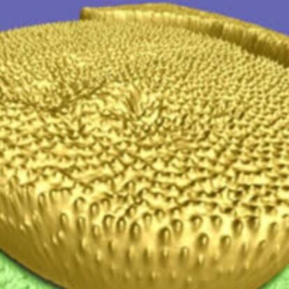 <i>Glóbulos rojos infectados por el parásito de la malaria</i>, ganadora del concurso SPMAGE09 de imágenes de nanociencia.