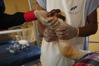 Una paciente es tratada en el centro de salud de Saint Michel, en Zoukoubé (Costa de Marfil), de las heridas causadas en su brazo por la úlcera de Buruli. Aunque el tratamiento con antibióticos se prolonga ocho semanas, la recuperación puede llevar muchos más meses hasta que cicatrizan las lesiones. 