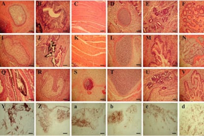 Cuatro de las líneas de células madre embrionarias derivadas por clonación de pacientes (una en cada fila), diferenciadas en el laboratorio en ocho clases de tejidos humanos (uno en cada columna).