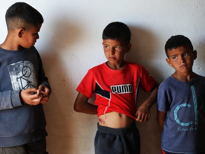 Naser (center), Amina's brother, shows the injury caused while he was running to flee the Iranian attack when a piece of projectile fell into the room where the family was sleeping.