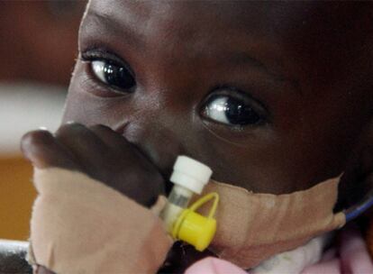 Una niña portadora del VIH, en un hospital de Kampala (Uganda).