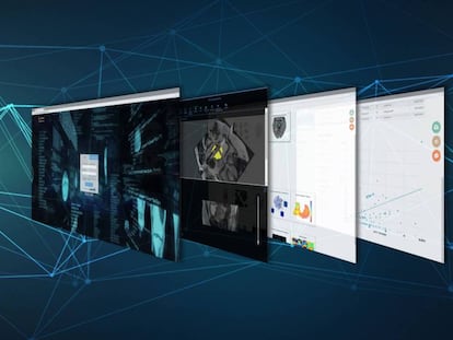 Inteligencia artificial valenciana para aconsejar si hospitalizar a un contagiado