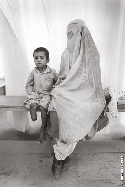 La foto tomada, en Kabul en agosto de 1996, muestra dos amputaciones: Sarwar, de 6 años, que ha perdido un ojo y una pierna por una mina antipersona, y la de la madre obligada a llevar burka. Sarwar fue herido seis meses antes, en febrero, mientras recogía leña", por Gervasio Sánchez. La imagen forma parte del proyecto <i>Vidas minadas</i>.