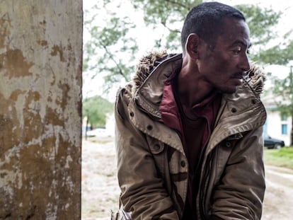 Un minero ilegal, paciente de tuberculosis, en Fort Dauphine, en Madagascar.
