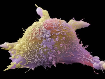 Inmunoterapia contra el cáncer: un nuevo paradigma